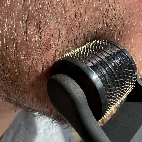 Copenhagen Beard Roller för att främja skäggväxt